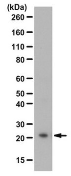 Anti-BAALC Antibody from rabbit, purified by affinity chromatography