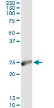 Monoclonal Anti-IGKC antibody produced in mouse clone 2E7, purified immunoglobulin, buffered aqueous solution