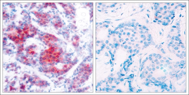 Anti-phospho-STAT4 (pTyr693) antibody produced in rabbit affinity isolated antibody