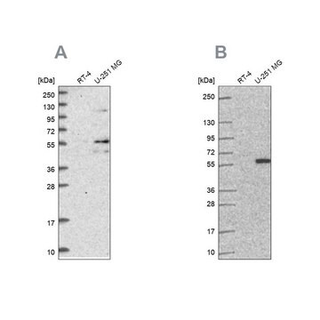 Anti-ACSBG1 antibody produced in rabbit Prestige Antibodies&#174; Powered by Atlas Antibodies, affinity isolated antibody, buffered aqueous glycerol solution