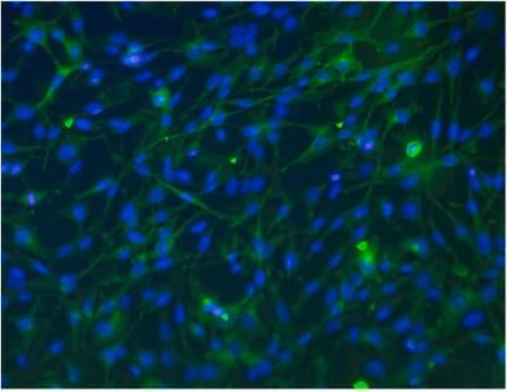 Anti-SLC4A11 Antibody from rabbit, purified by affinity chromatography