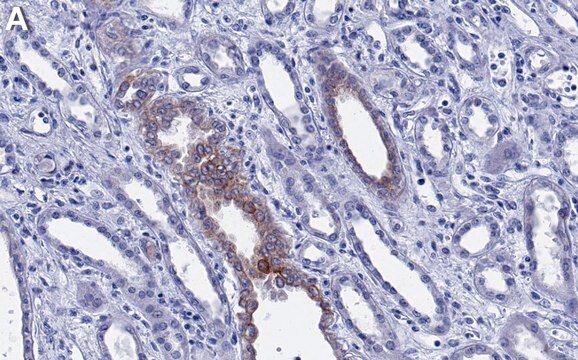 Anti-LRP6 Antibody, clone 1D11 ZooMAb&#174; Rabbit Monoclonal recombinant, expressed in HEK 293 cells