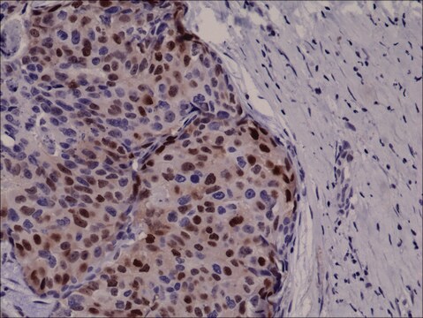 Anti-Cyclin D1 antibody, Rabbit monoclonal recombinant, expressed in HEK 293 cells, clone RM241, purified immunoglobulin