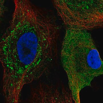 Anti-CKS2 antibody produced in rabbit Prestige Antibodies&#174; Powered by Atlas Antibodies, affinity isolated antibody