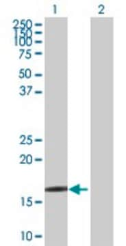 Anti-CRYGD antibody produced in rabbit purified immunoglobulin, buffered aqueous solution