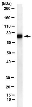 Anti-Factor XII Antibody, clone 9A2 clone 9A2, from mouse