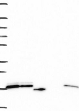 Anti-RPS24 antibody produced in rabbit Prestige Antibodies&#174; Powered by Atlas Antibodies, affinity isolated antibody, buffered aqueous glycerol solution