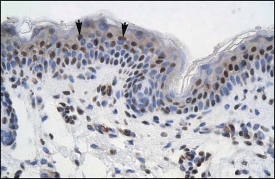 Anti-GTF2I antibody produced in rabbit affinity isolated antibody