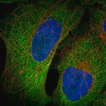 Anti-Prelp Antibody Produced In Rabbit Prestige Antibodies&#174; Powered by Atlas Antibodies, affinity isolated antibody, buffered aqueous glycerol solution