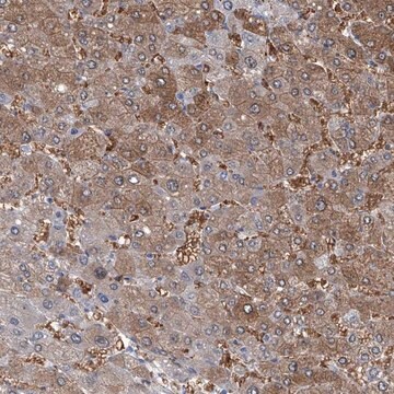 Anti-PFKL antibody produced in rabbit Prestige Antibodies&#174; Powered by Atlas Antibodies, affinity isolated antibody, buffered aqueous glycerol solution