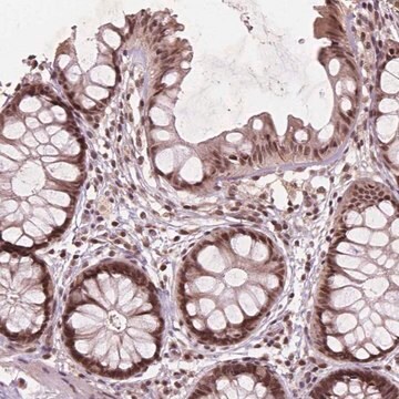 Anti-GPS2 antibody produced in rabbit Prestige Antibodies&#174; Powered by Atlas Antibodies, affinity isolated antibody