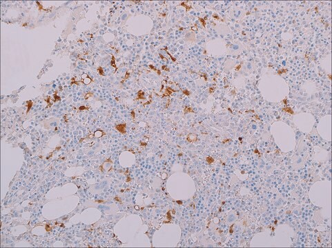 IDH1 R132H (MRQ-67) Rabbit Monoclonal Antibody