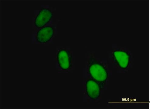 Anti-UBA2 antibody produced in mouse IgG fraction of antiserum, buffered aqueous solution