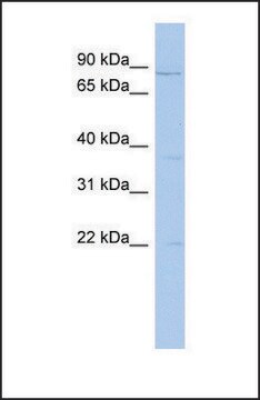 Anti-PCSK4, (N-terminal) antibody produced in rabbit affinity isolated antibody