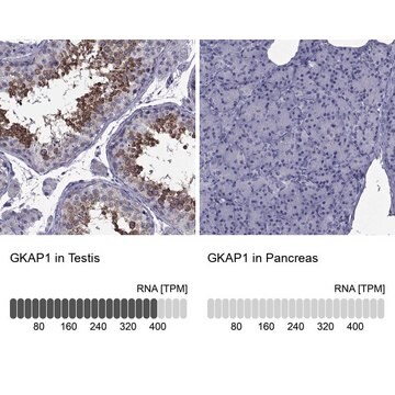 Anti-GKAP1 antibody produced in rabbit Prestige Antibodies&#174; Powered by Atlas Antibodies, affinity isolated antibody, buffered aqueous glycerol solution