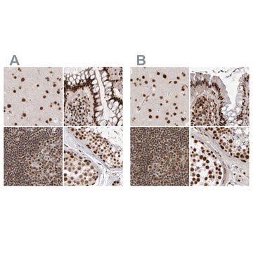 Anti-PPP1R8 antibody produced in rabbit Prestige Antibodies&#174; Powered by Atlas Antibodies, affinity isolated antibody, buffered aqueous glycerol solution, Ab2