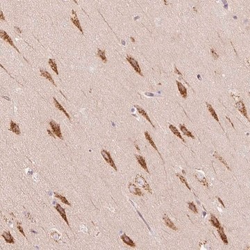 Anti-TBC1D2B antibody produced in rabbit Prestige Antibodies&#174; Powered by Atlas Antibodies, affinity isolated antibody, buffered aqueous glycerol solution