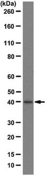 Anti-TATA-box-binding protein Antibody, clone SL30-3-563 clone SL30-3-563, from mouse