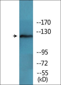 抗 磷酸化 FAK (pTyr 397 ) 兔抗 affinity isolated antibody