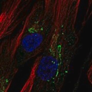 Anti-CHI3L1 antibody produced in rabbit Prestige Antibodies&#174; Powered by Atlas Antibodies, affinity isolated antibody, buffered aqueous glycerol solution