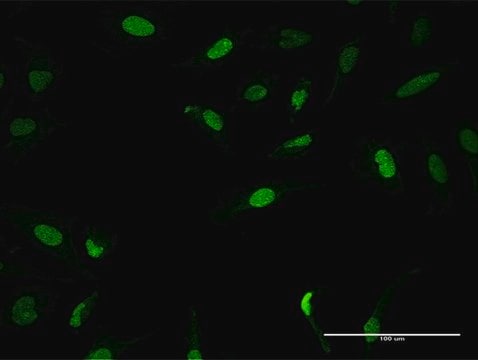 Anti-ZNF582 antibody produced in mouse purified immunoglobulin, buffered aqueous solution