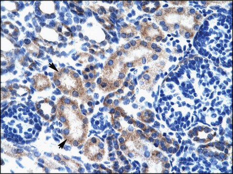 Anti-ONECUT2 antibody produced in rabbit IgG fraction of antiserum