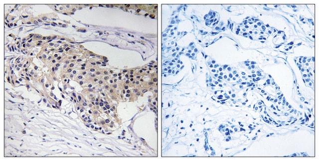 Anti-NDUFA3 antibody produced in rabbit affinity isolated antibody