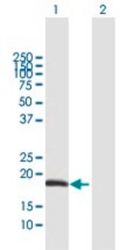 Anti-ODAM antibody produced in mouse purified immunoglobulin, buffered aqueous solution