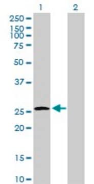 Anti-UROS antibody produced in mouse purified immunoglobulin, buffered aqueous solution