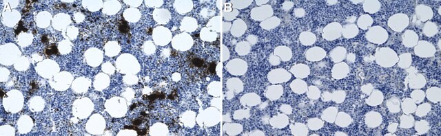 Anti-CD41/ITGA2B Antibody, clone 1F9 ZooMAb&#174; Rabbit Monoclonal recombinant, expressed in HEK 293 cells