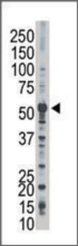 Anti-PFKFB2 (C-term) antibody produced in rabbit IgG fraction of antiserum, buffered aqueous solution