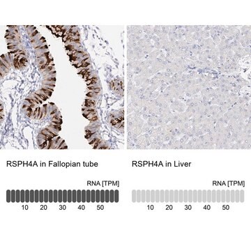 Anti-RSPH4A antibody produced in rabbit Prestige Antibodies&#174; Powered by Atlas Antibodies, affinity isolated antibody, buffered aqueous glycerol solution