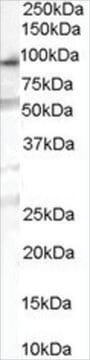 Anti-OSBPL10 antibody produced in goat affinity isolated antibody, buffered aqueous solution