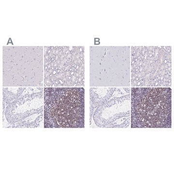 Anti-IKZF1 antibody produced in rabbit Prestige Antibodies&#174; Powered by Atlas Antibodies, affinity isolated antibody, buffered aqueous glycerol solution