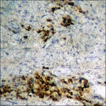 Anti-phospho-HDAC3 (pSer424) antibody produced in rabbit affinity isolated antibody