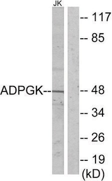 Anti-ADPGK antibody produced in rabbit affinity isolated antibody