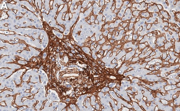 Anti-Collagen VI Antibody, clone 1N10 ZooMAb&#174; Rabbit Monoclonal recombinant, expressed in HEK 293 cells