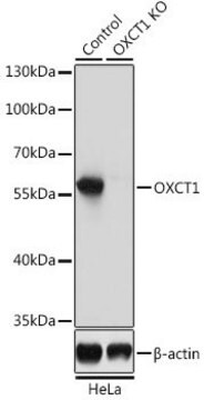 Anti-OXCT1 antibody produced in rabbit