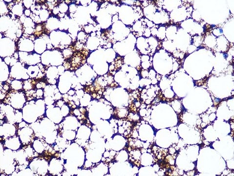 Anti-Perilipin A antibody produced in rabbit