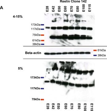 Anti-Reelin Antibody, a.a. 164-189 mreelin, clone 142 clone 142, Chemicon&#174;, from mouse