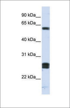 Anti-HABP2 antibody produced in rabbit affinity isolated antibody