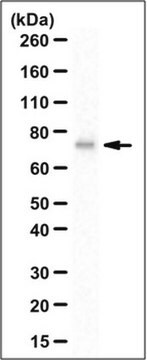 Anti-SNX18 Antibody from rabbit, purified by affinity chromatography