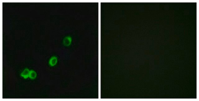 Anti-ACOT1 antibody produced in rabbit affinity isolated antibody