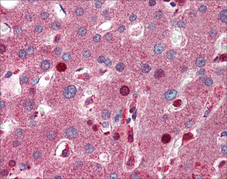 Anti-C8B (AB2) antibody produced in rabbit affinity isolated antibody