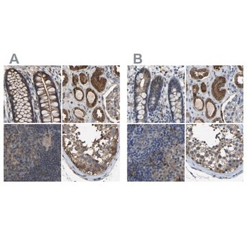 Anti-FHIT antibody produced in rabbit Prestige Antibodies&#174; Powered by Atlas Antibodies, affinity isolated antibody, buffered aqueous glycerol solution