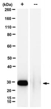 Anti-phospho-BRCA1 (Ser114) Antibody, clone 3C10G8