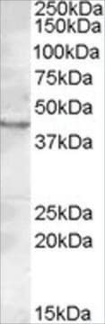 Anti-LASS3/CERS3 antibody produced in goat affinity isolated antibody, buffered aqueous solution