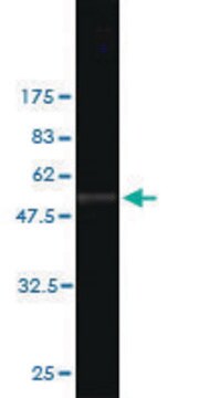 Monoclonal Anti-SLC45A2 antibody produced in mouse clone 1B2, purified immunoglobulin, buffered aqueous solution