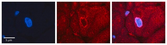 Anti-RPS3 (C-terminal) antibody produced in rabbit affinity isolated antibody