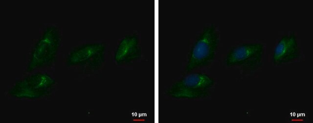 Anti-ENPP2 antibody produced in rabbit affinity isolated antibody, buffered aqueous solution